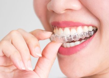 ortodoncia-invisalign